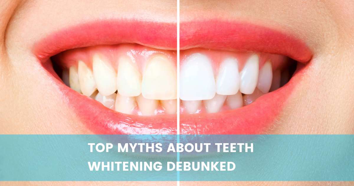 teeth whitening myths